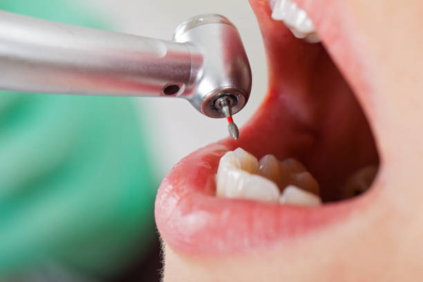 Best Urgent Dental Care for Toothache in St Augustine South, FL
